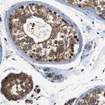 TMED2 Antibody in Immunohistochemistry (Paraffin) (IHC (P))