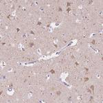 CHRM1 Antibody in Immunohistochemistry (Paraffin) (IHC (P))