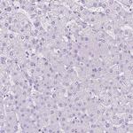 CHRM1 Antibody in Immunohistochemistry (Paraffin) (IHC (P))