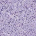 CHRM1 Antibody in Immunohistochemistry (Paraffin) (IHC (P))