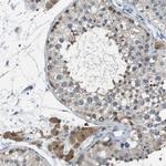 NANOS2 Antibody in Immunohistochemistry (Paraffin) (IHC (P))