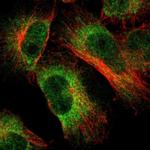 LNP Antibody in Immunocytochemistry (ICC/IF)