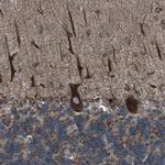 LNP Antibody in Immunohistochemistry (Paraffin) (IHC (P))