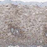 LNP Antibody in Immunohistochemistry (Paraffin) (IHC (P))