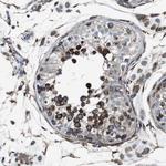 LNP Antibody in Immunohistochemistry (Paraffin) (IHC (P))