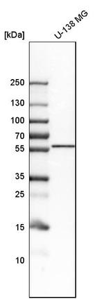 LNP Antibody in Western Blot (WB)