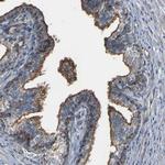 MYOF Antibody in Immunohistochemistry (Paraffin) (IHC (P))