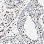 MYOF Antibody in Immunohistochemistry (IHC)