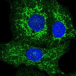 GDAP1 Antibody in Immunocytochemistry (ICC/IF)