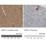 GDAP1 Antibody in Immunohistochemistry (IHC)