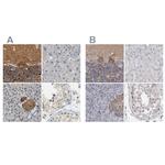 GDAP1 Antibody in Immunohistochemistry (IHC)