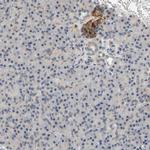 GDAP1 Antibody in Immunohistochemistry (IHC)