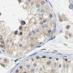 GDAP1 Antibody in Immunohistochemistry (IHC)