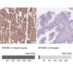 MYOM1 Antibody in Immunohistochemistry (IHC)