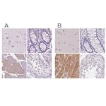 MYOM1 Antibody in Immunohistochemistry (IHC)