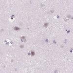 MYOM1 Antibody in Immunohistochemistry (IHC)