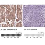 MYOM1 Antibody