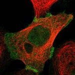 PKP2 Antibody in Immunocytochemistry (ICC/IF)