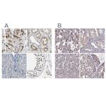 PKP2 Antibody in Immunohistochemistry (IHC)