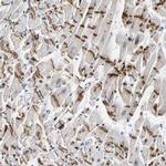 PKP2 Antibody in Immunohistochemistry (IHC)