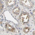 PKP2 Antibody in Immunohistochemistry (IHC)