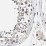 PKP2 Antibody in Immunohistochemistry (IHC)