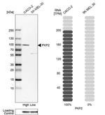 PKP2 Antibody in Western Blot (WB)