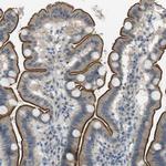 UGT8 Antibody in Immunohistochemistry (IHC)