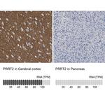 PRRT2 Antibody