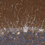 PRRT2 Antibody in Immunohistochemistry (IHC)