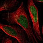 DHPS Antibody in Immunocytochemistry (ICC/IF)