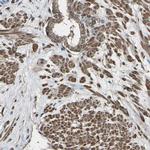 DHPS Antibody in Immunohistochemistry (IHC)