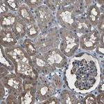 DHPS Antibody in Immunohistochemistry (IHC)