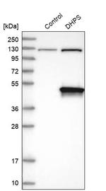 DHPS Antibody in Western Blot (WB)