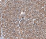 TMEM30A Antibody in Immunohistochemistry (IHC)