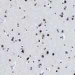 TMEM55A Antibody in Immunohistochemistry (Paraffin) (IHC (P))