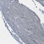 MARCH1 Antibody in Immunohistochemistry (Paraffin) (IHC (P))