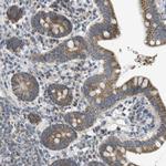 MARCH1 Antibody in Immunohistochemistry (Paraffin) (IHC (P))