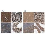 ARHGEF11 Antibody in Immunohistochemistry (IHC)