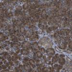 DPM3 Antibody in Immunohistochemistry (Paraffin) (IHC (P))