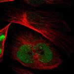 EMP2 Antibody in Immunocytochemistry (ICC/IF)