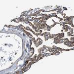 EMP2 Antibody in Immunohistochemistry (IHC)