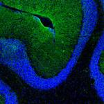 Aquaporin 4 Antibody in Immunocytochemistry (ICC/IF)