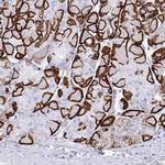 Aquaporin 4 Antibody in Immunohistochemistry (IHC)