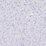 Aquaporin 4 Antibody in Immunohistochemistry (IHC)