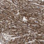 BVES Antibody in Immunohistochemistry (Paraffin) (IHC (P))