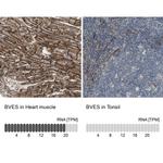 BVES Antibody in Immunohistochemistry (IHC)