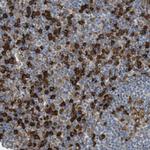 MBOAT2 Antibody in Immunohistochemistry (Paraffin) (IHC (P))