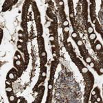 MBOAT2 Antibody in Immunohistochemistry (Paraffin) (IHC (P))