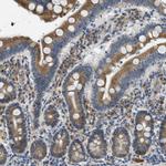 MPDU1 Antibody in Immunohistochemistry (Paraffin) (IHC (P))